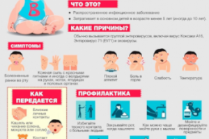 Вирус Коксаки